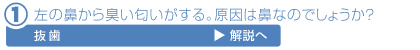 抜歯解説へ