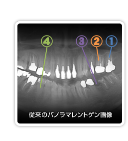 歯科用CT解説「レントゲン画像」